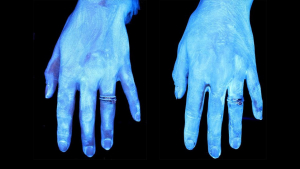 Κορωνοιός Υπέρυθρες  δείχνουν καθαρά  και βρώμικα χέρια