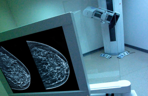Δωρεάν ψηφιακή <br> μαστογραφία σε 1,2 εκ. <br> γυναίκες στην Ελλάδα