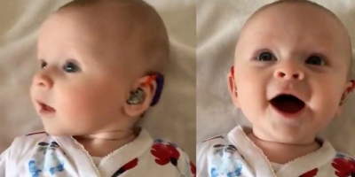 Κοριτσάκι 4 μηνών ακούει <br> για πρώτη φορά <br> Το γέλιο του (βίντεο)