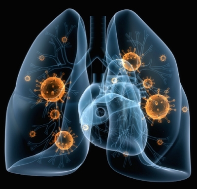 Οι 6 τροφές που <br> καθαρίζουν τα πνευμόνια <br> από το κάπνισμα